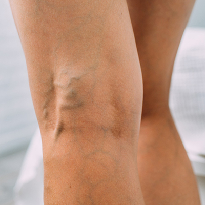 Картинка статьи