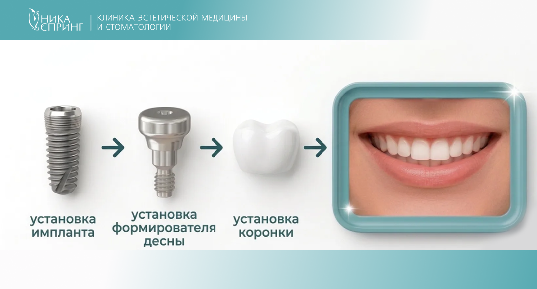 Фторирование, герметизация фиссур (6).png