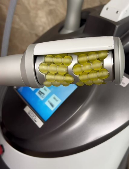 эндосфера лица 3.jpg