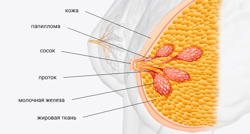 папиллома внутрипротоковая.jpg папиллома внутрипротоковая.jpg
