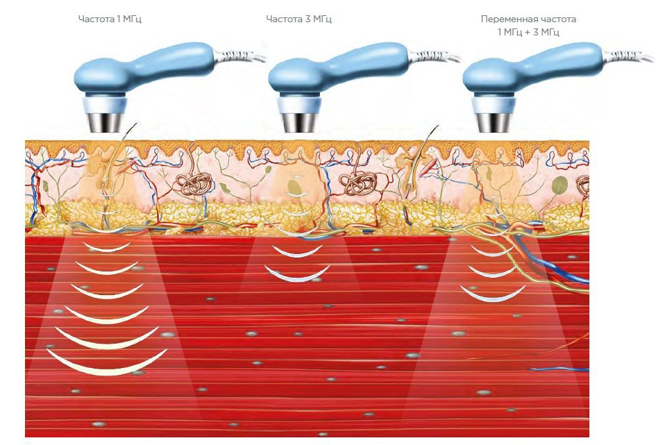 376v2p837de3grj4on3yo2ab32outlm0 копия.jpg