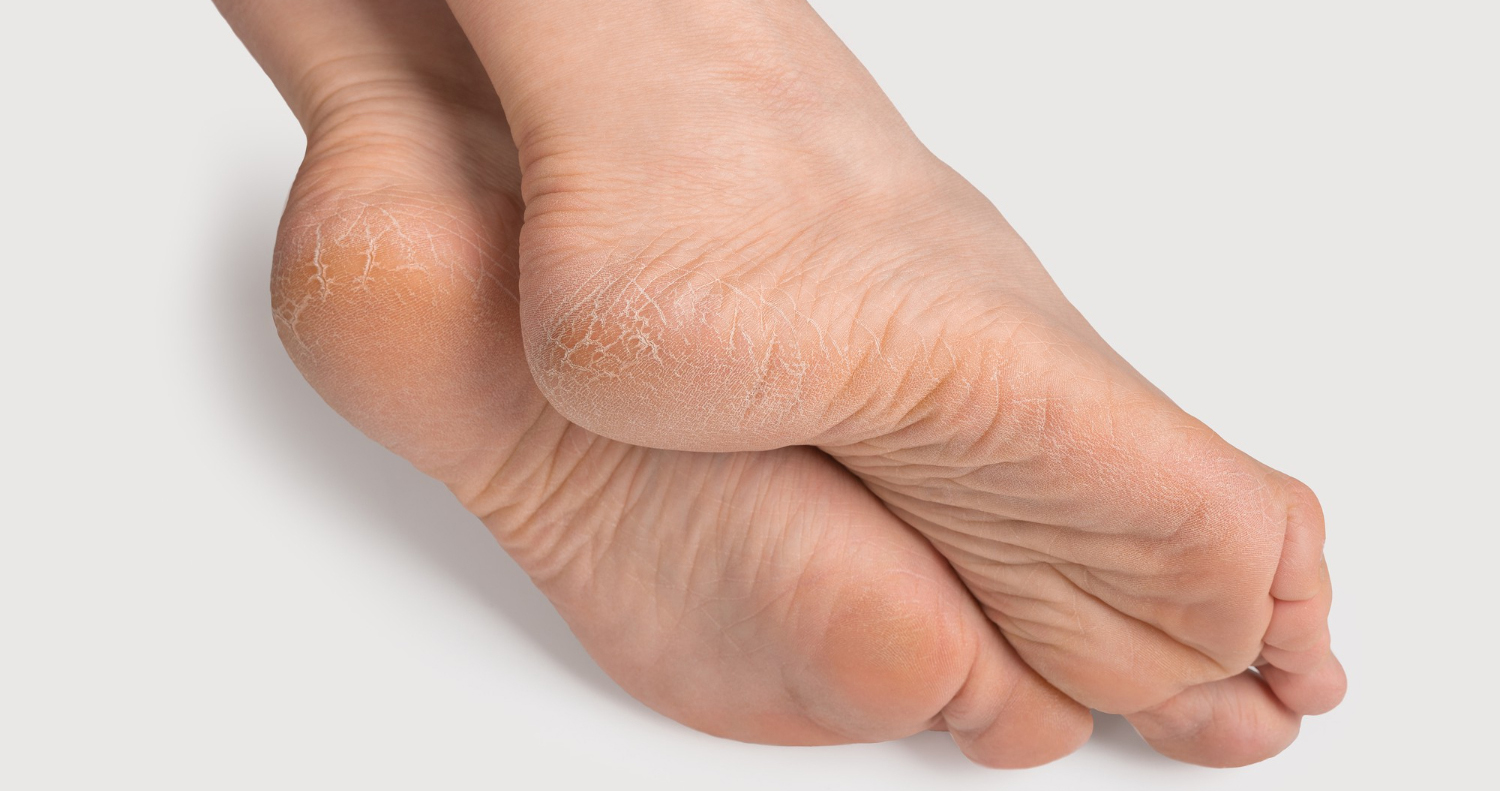 грибок статья.jpg