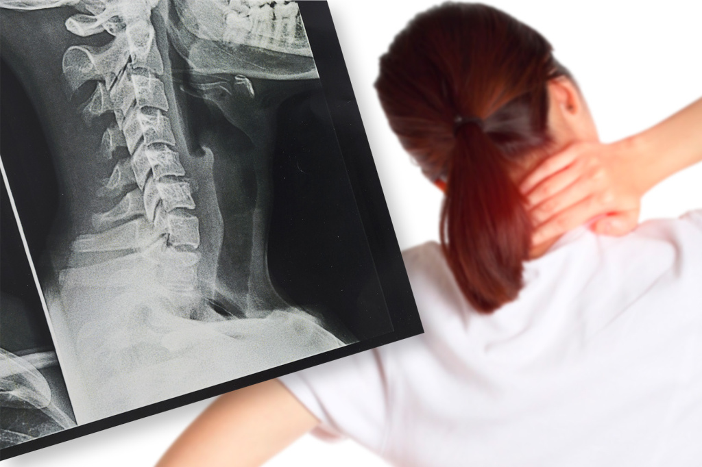 x-ray-scan.jpg x-ray-scan.jpg